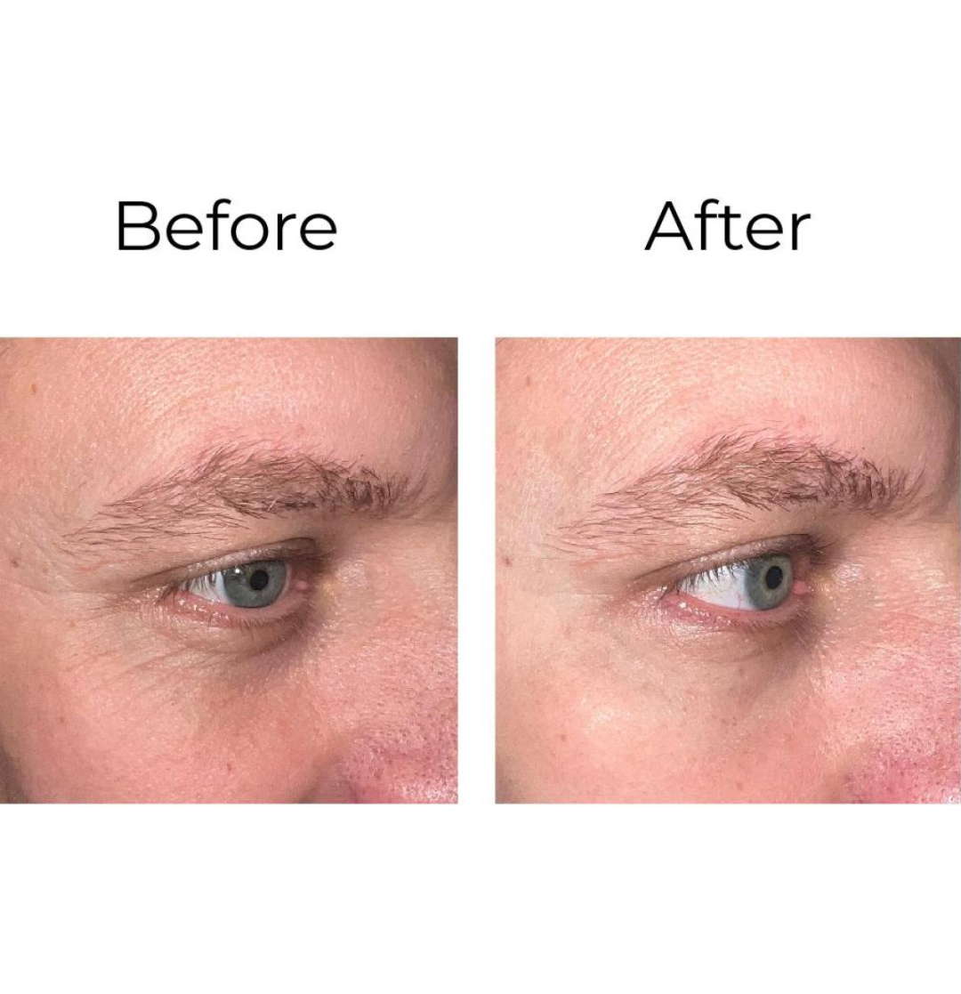 Peptilux – Anti-Falten Augencreme „Shock Action"-Effekt mit LIPHASYN™