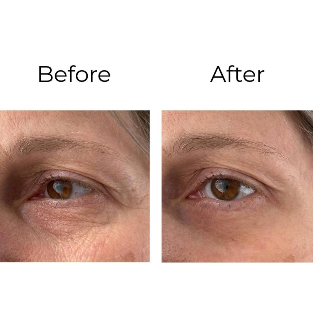 Peptilux – Anti-Falten Augencreme „Shock Action"-Effekt mit LIPHASYN™