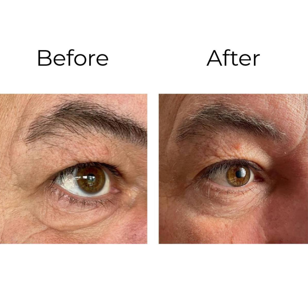 Peptilux – Anti-Falten Augencreme „Shock Action"-Effekt mit LIPHASYN™
