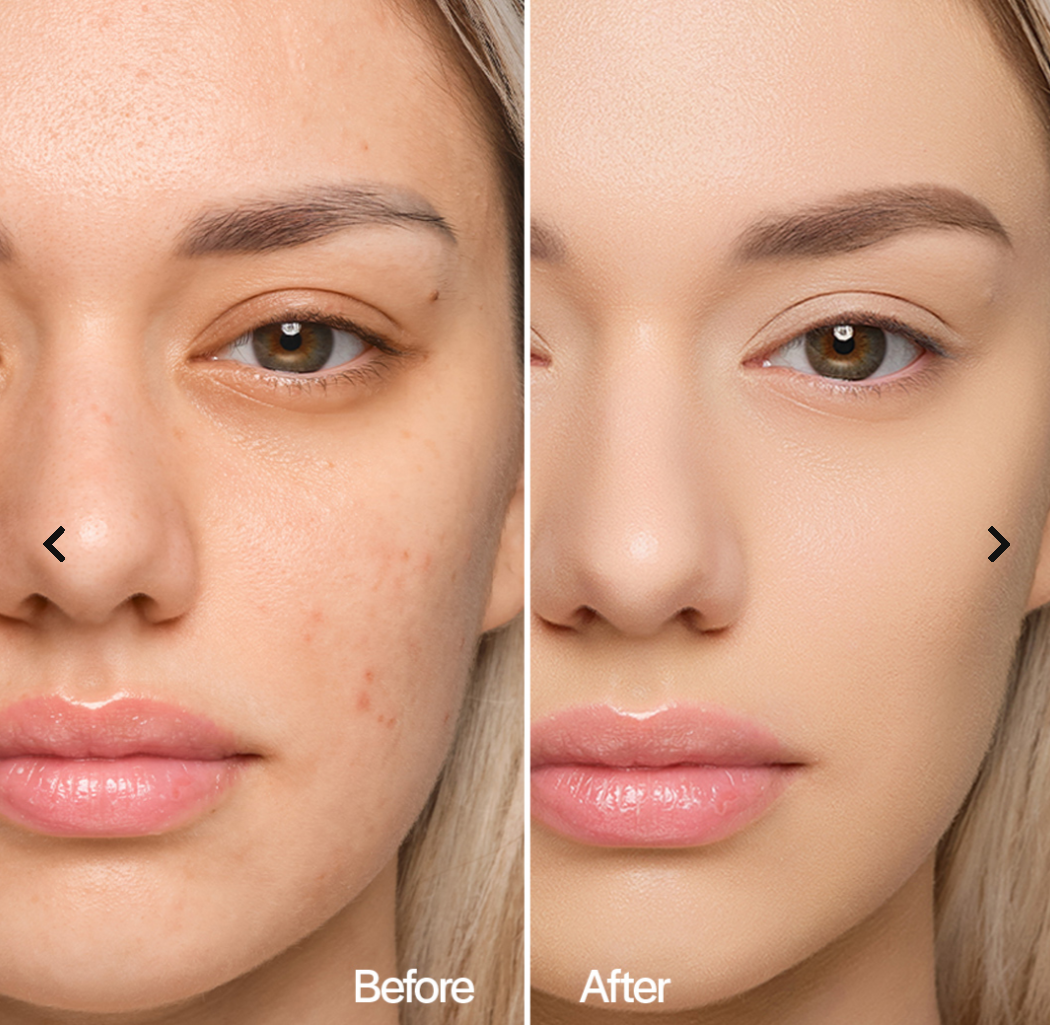 Solar Defence Compact Foundation – Meringa