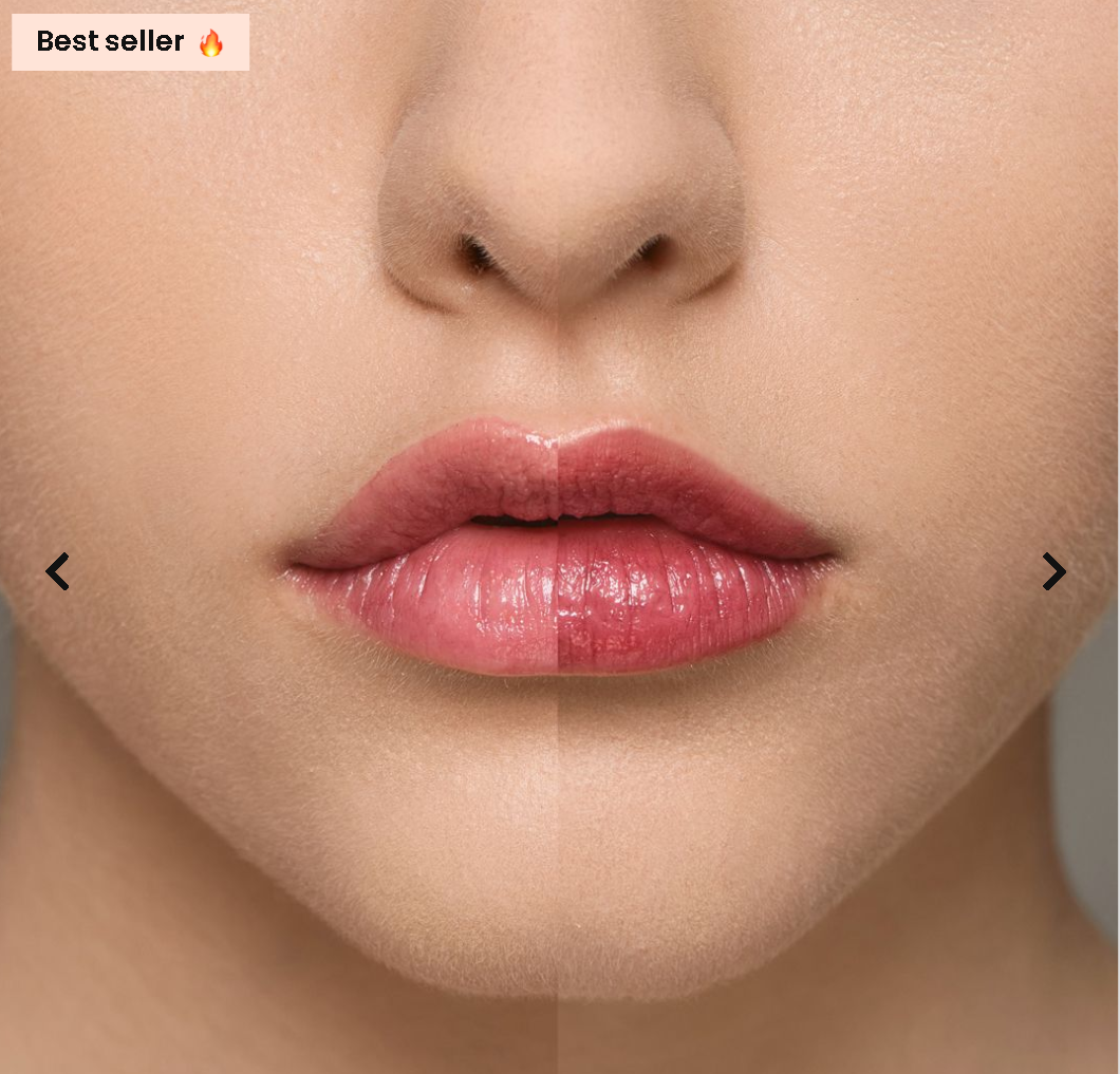 Supreme Lip Treatment – Himbeere